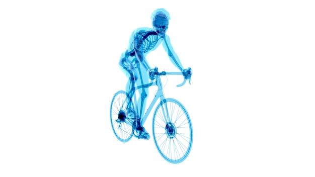 Variaciones de los sueños de pedal